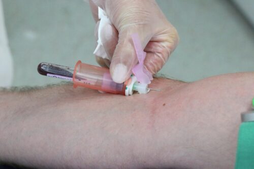 Dlaczego warto badać krew? Klucz do zdrowia na wyciągnięcie ręki