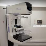 Bezpłatna cyfrowa mammografia LUX MED w czerwcu 2025