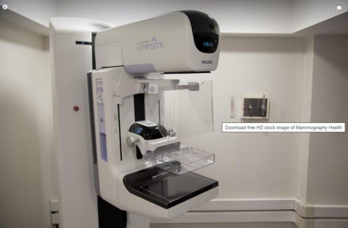 Bezpłatna cyfrowa mammografia LUX MED w czerwcu 2025